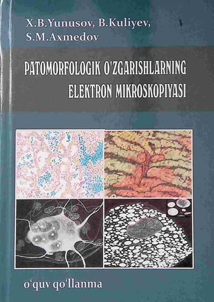 patamorfologik o'zgarishlarning elektron mikroskopiyasi